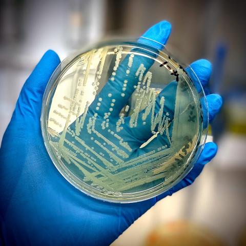 Salmonella cells proliferate in an agar plate.