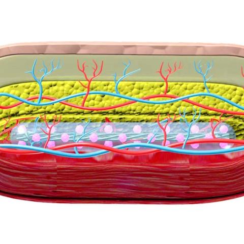 Researchers created a thread-like device that can be implanted under the skin to secrete insulin via islet cells (the tiny pink balls) while receiving nutrients and oxygen from blood vessels.